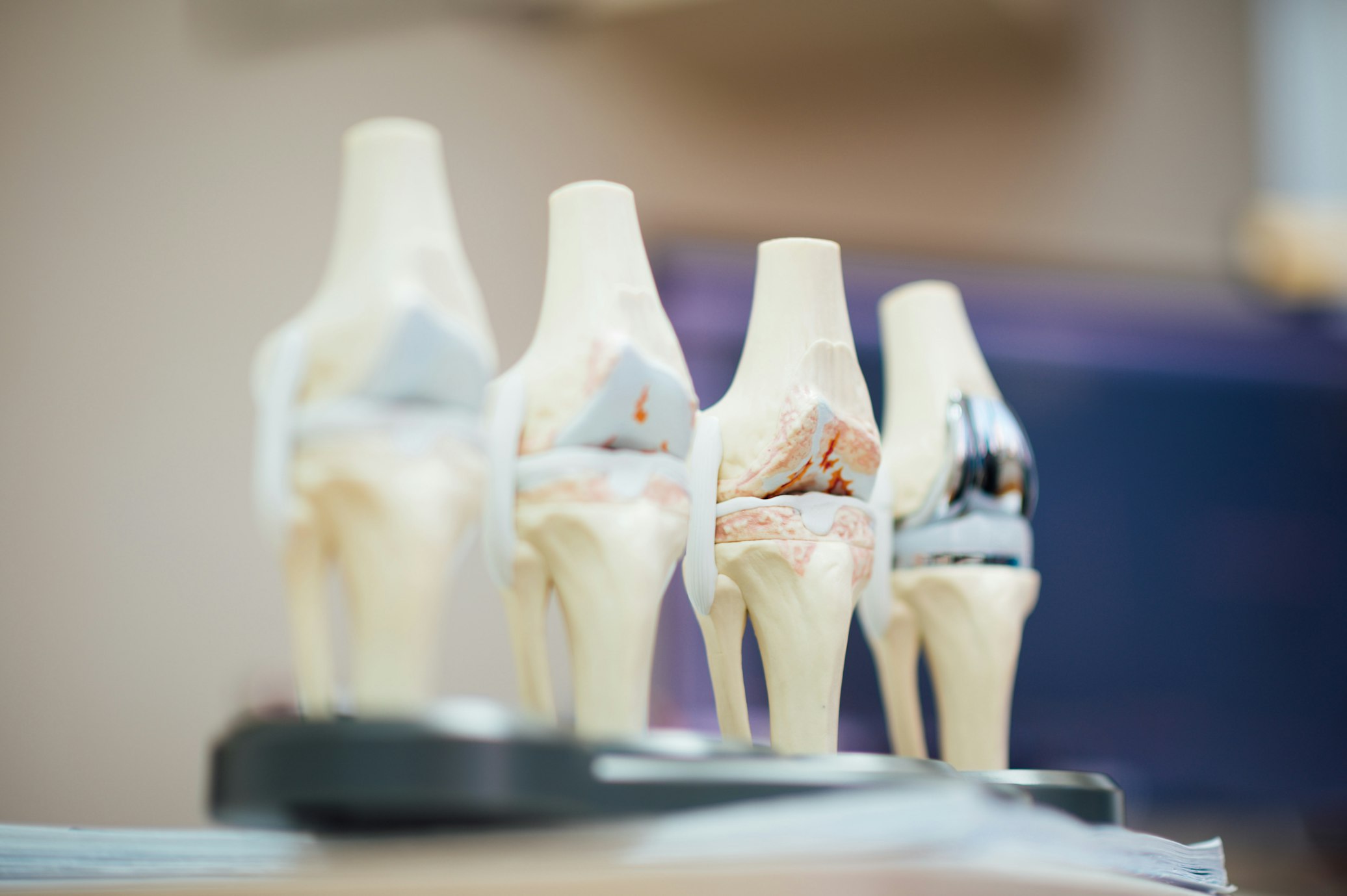 Orthopaedics